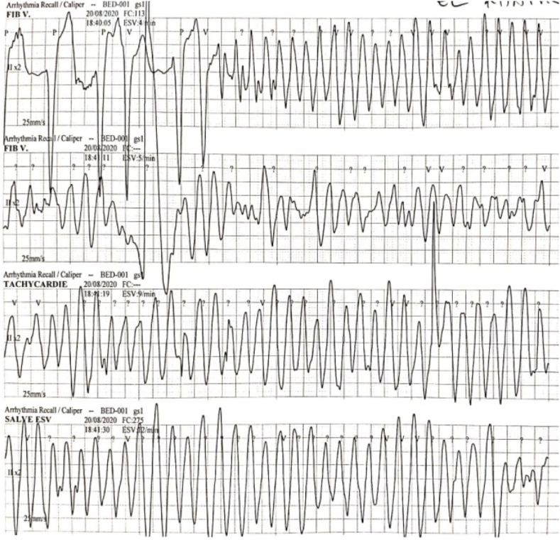 Fig. 4