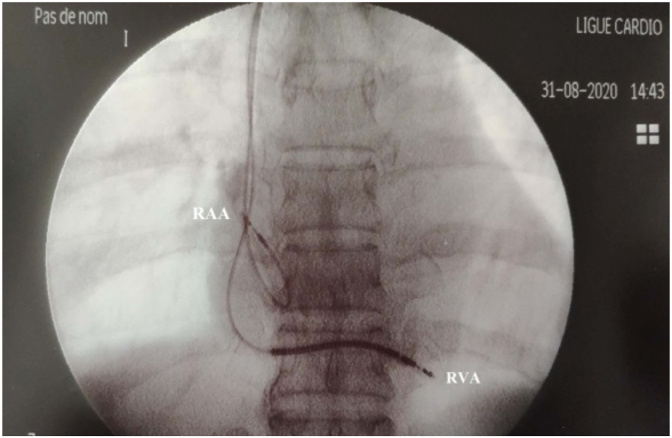 Fig. 5