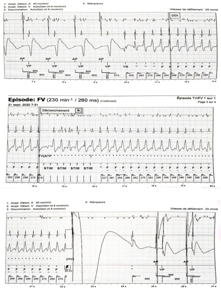 Fig. 6