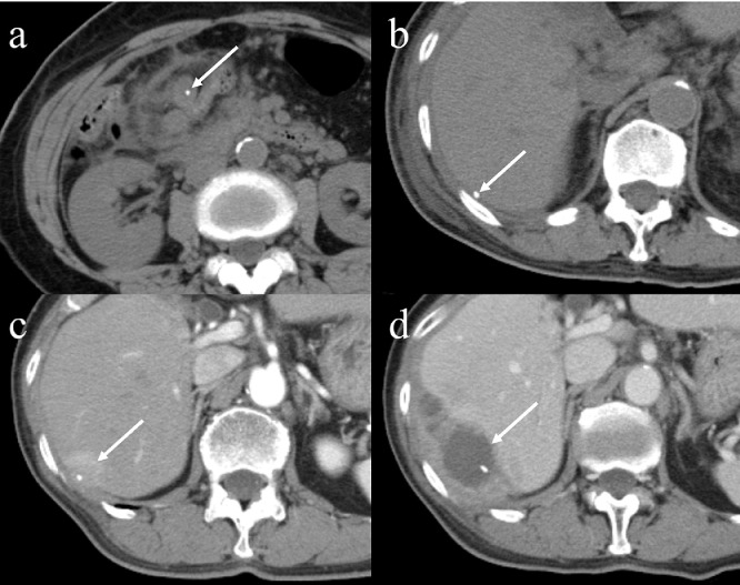 Fig 2 –