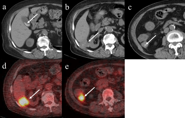 Fig 1 –