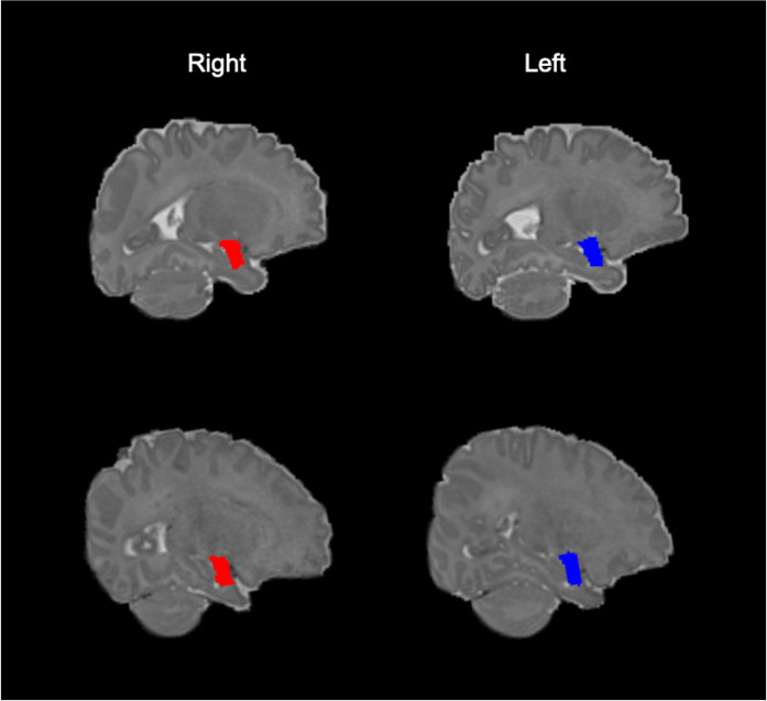 Figure 2—figure supplement 1.