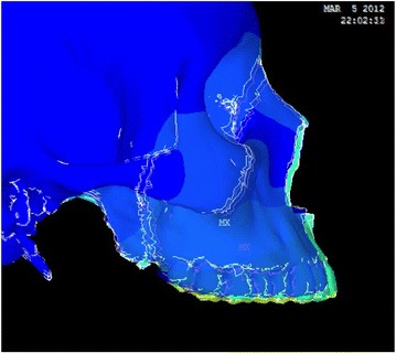 Fig. 12