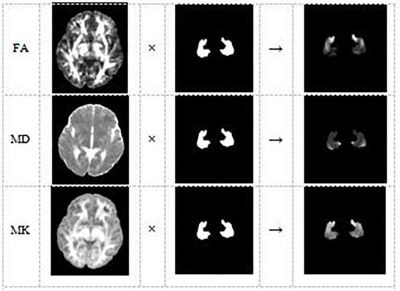 FIGURE 3