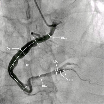 Fig. 1