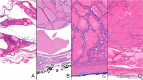Fig.1