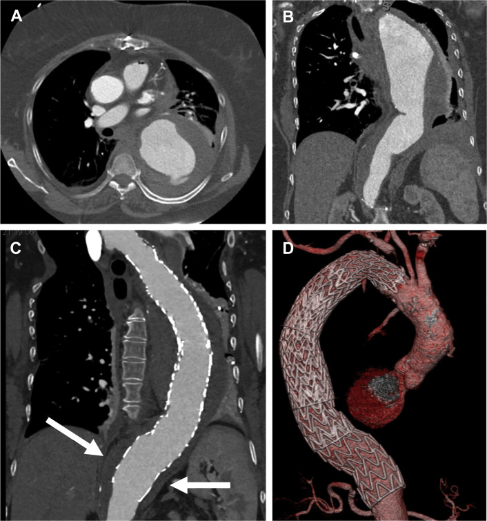 Fig 1