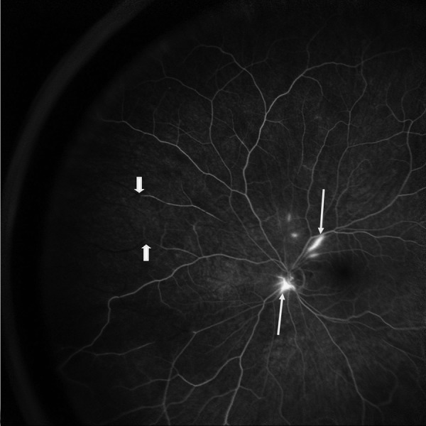 Figure 2