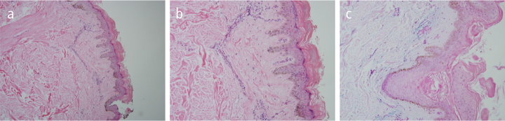 Figure 2. a, c