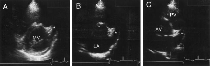 Figure 1  