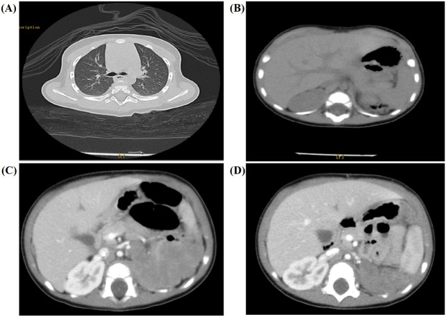 Figure 1