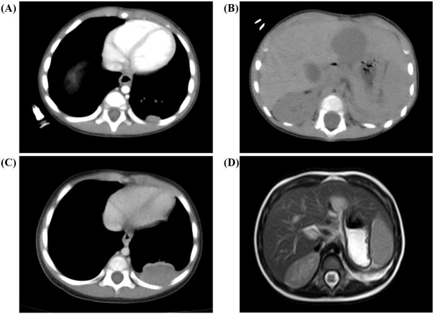 Figure 2