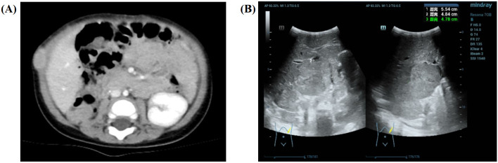 Figure 4