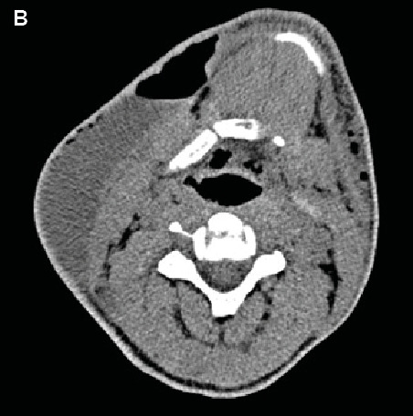 FIGURE 1B: