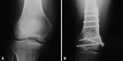 Fig. 6A–B