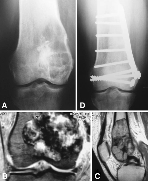 Fig. 2A–D