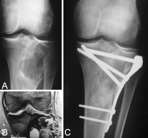 Fig. 4A–C