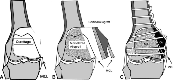 Fig. 1A–C