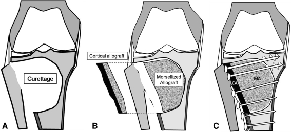 Fig. 3A–C