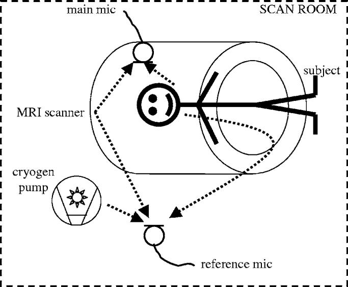 FIG. 3