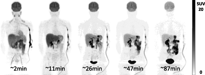 Fig. 1