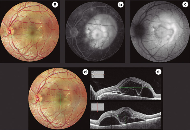 Fig. 1