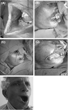 Fig. 1