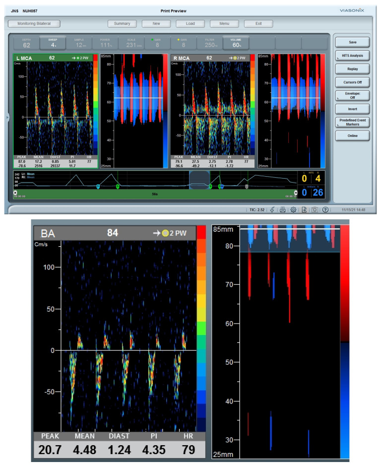 Figure 4