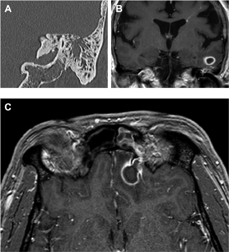 Fig 2