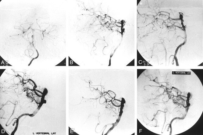 Fig 3.