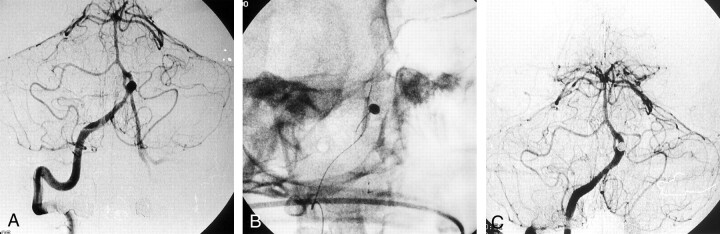 Fig 2.