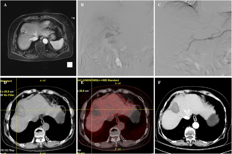 FIGURE 3