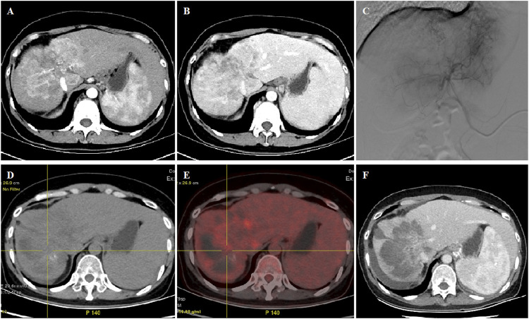 FIGURE 1