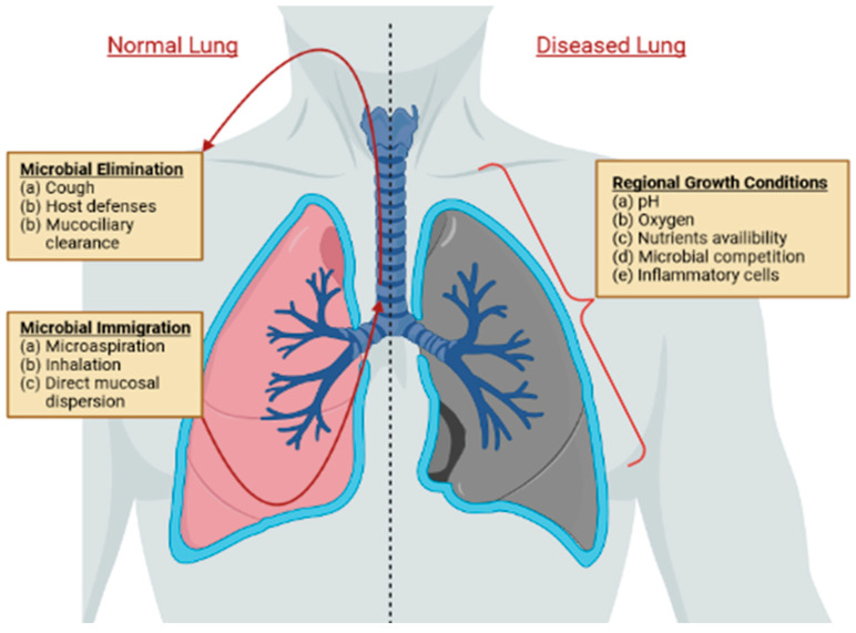 The Lung Microbiota and Lung Cancer: A Growing Relationship - PMC