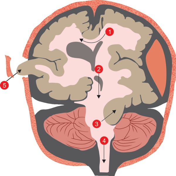 Fig. 2