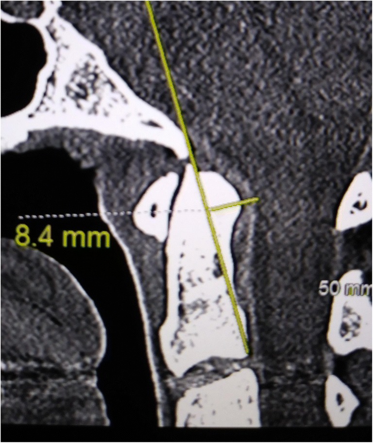 Fig. 3