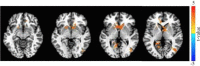 Figure 4—figure supplement 2.