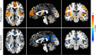 Figure 4—figure supplement 1.