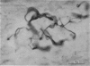 44P
