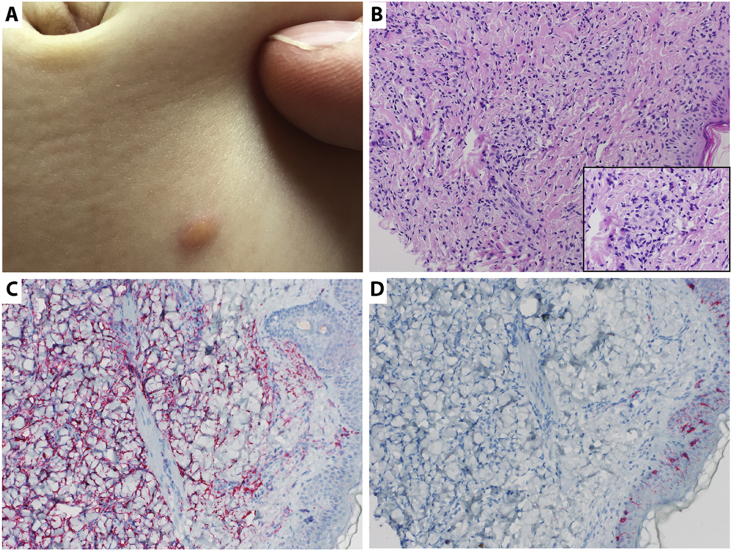 Fig. 2