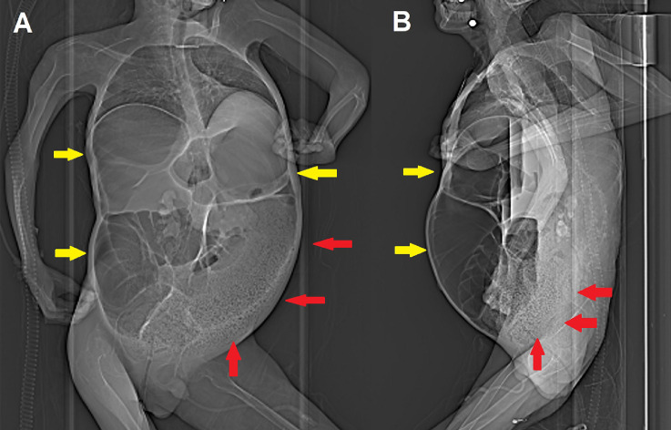 Fig 1