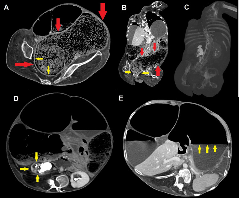 Fig 3