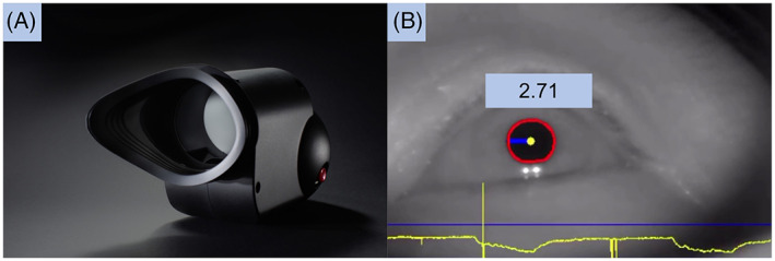 FIGURE 1