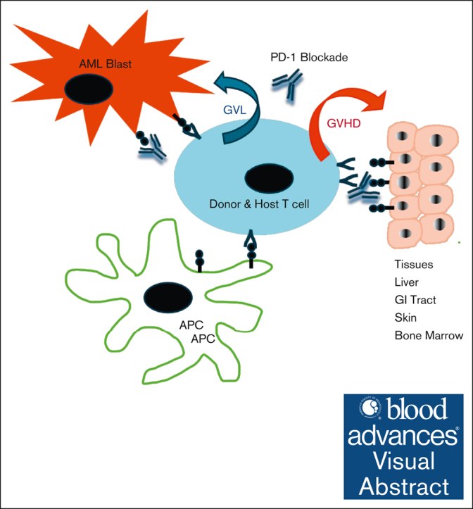 graphic file with name BLOODA_ADV-2024-015200-ga1.jpg