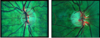 Fig. 10.