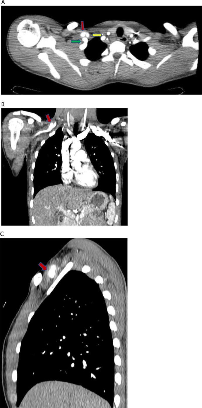 Fig 2