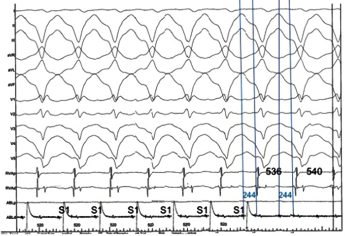 Figure 1: