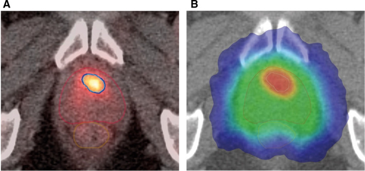 Fig. 4