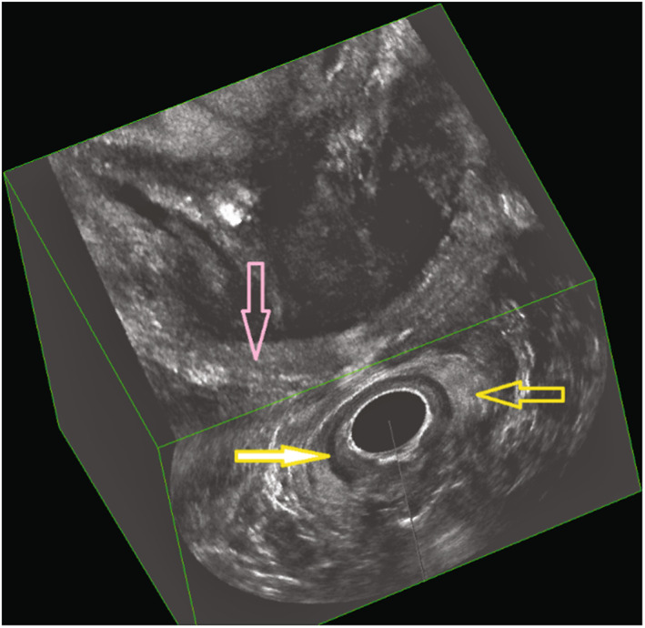 FIGURE 3