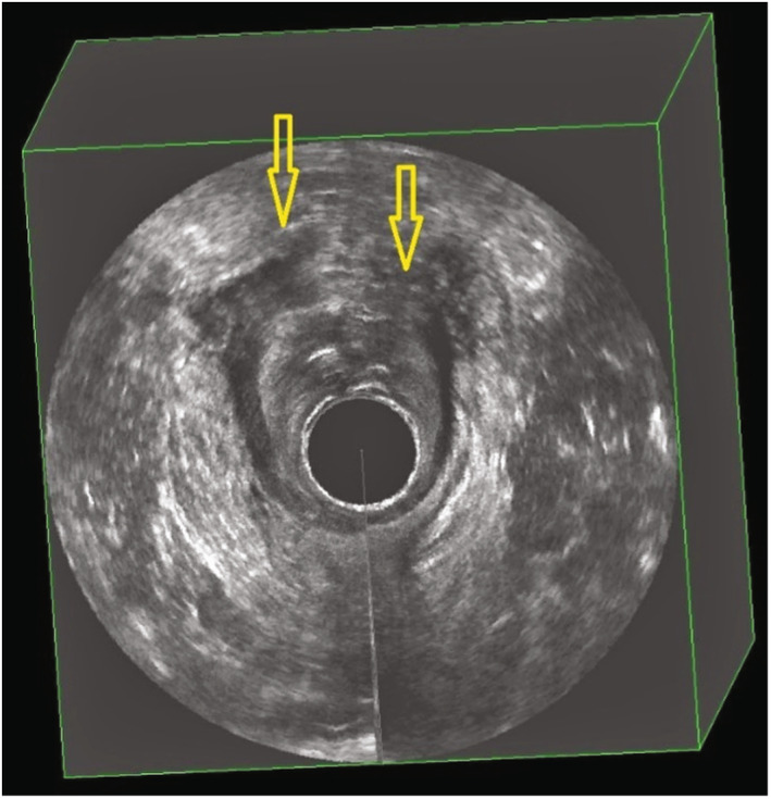 FIGURE 4